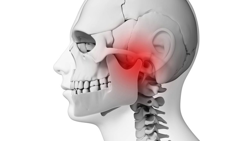 Distúrbio Temporomandibular (DTM): Quais são os Sintomas, Causas e Opções de Tratamento?